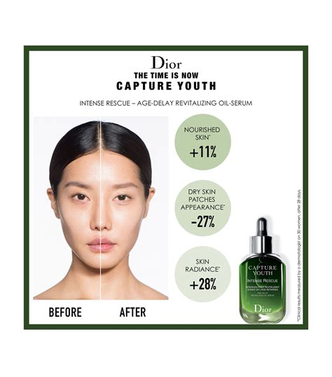 dior capture youth intense rescue serum review|Dior Capture totale reviews.